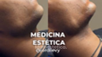 Armonización facial - Clínica Opción Médica