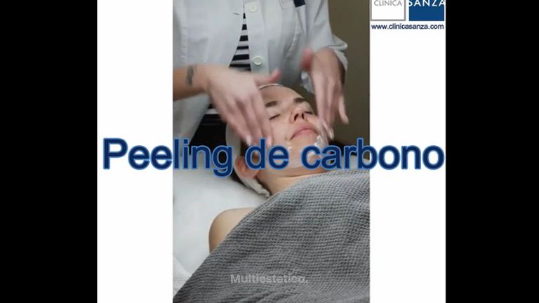 Peeling - Clínica Sanza