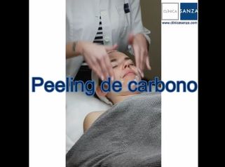 Peeling - Clínica Sanza