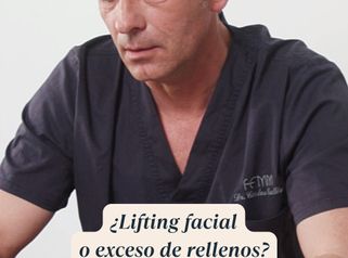 ¿Lifting facial o exceso de rellenos?