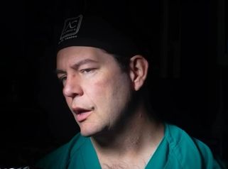 Radix bajo, giba prominente y una armonización completa del perfil facial.