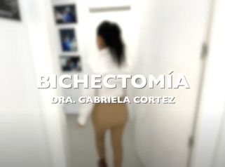 Bichectomía - Aura Clínica