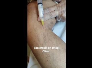 Esclerosis - IMSEI CLINIC