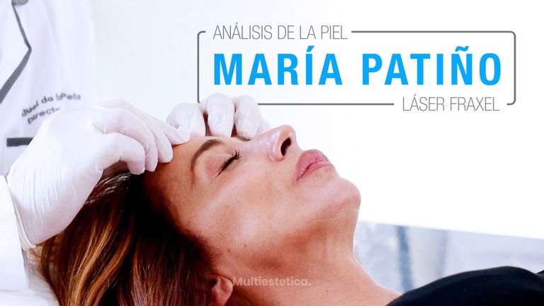 Rejuvenecimiento Facial de María Patiño