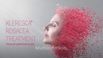 Tratamiento Rosácea - Clínica Openderma