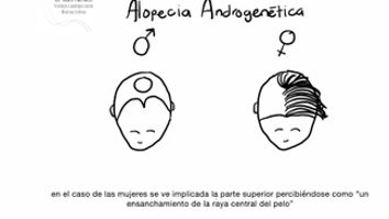 Alopecia Androgenética - CCCI Grupo Tufet