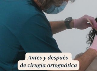 Antes y después de cirugía ortognática