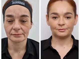 Clínica Carlos Gómez - rejuvenecimiento