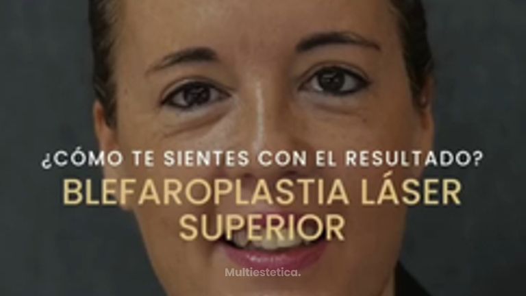 Blefaroplastia Láser Superior