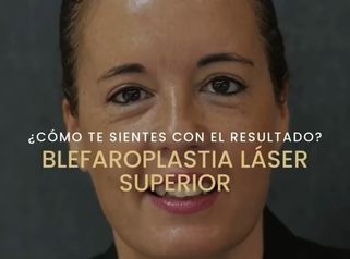 Blefaroplastia Láser Superior