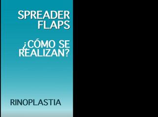 Spreader Flaps