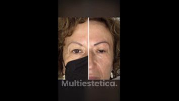 Microblading - Quirbody Clínica