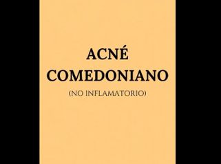 Acné comedoniano - Clínica Openderma