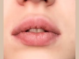 Dra. Andrea Tamargo - Si tienes los labios muy secos y agrietados