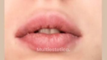 Dra. Andrea Tamargo - Si tienes los labios muy secos y agrietados