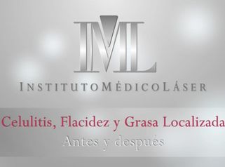Instituto Médico Láser -IML- muestra los resultados Antes-Despues