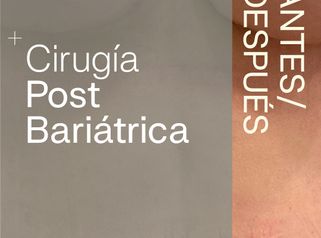 Resultados de cirugía postbariátrica