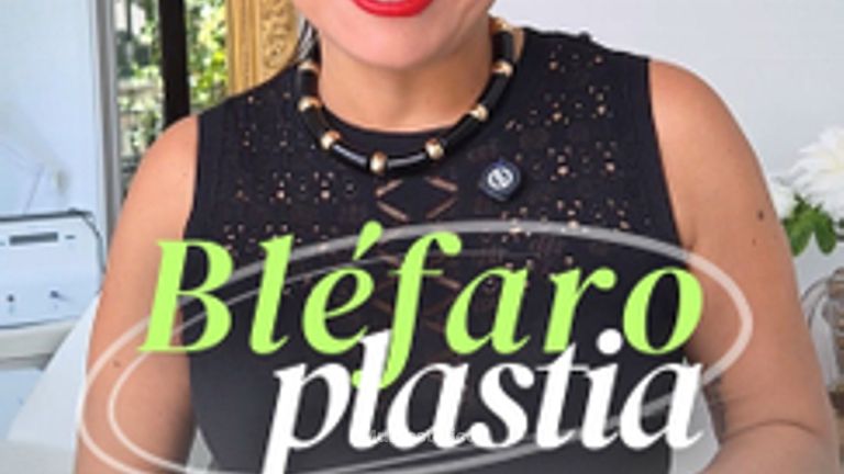BLEFAROPLASTIA