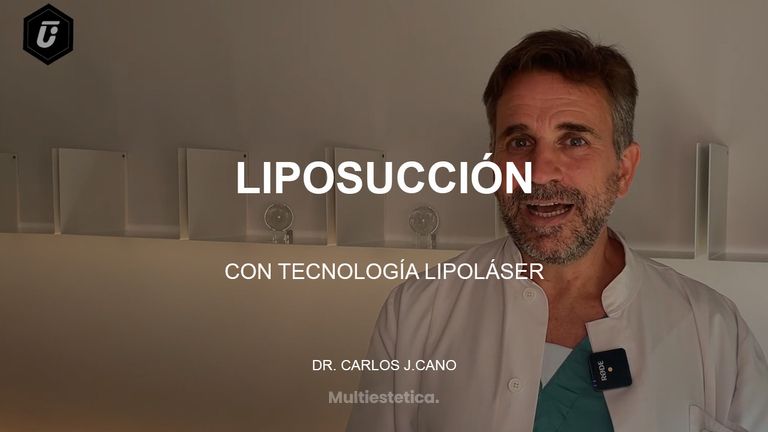 Liposucción con tecnologia lipolaser - Clínica Tufet