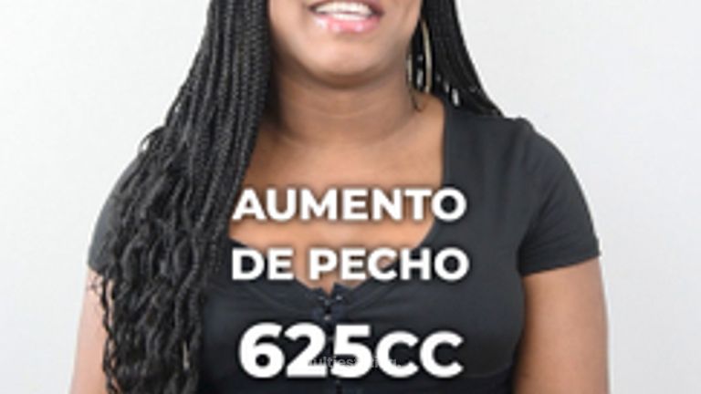Aumento de pecho - Clínica Opción Médica