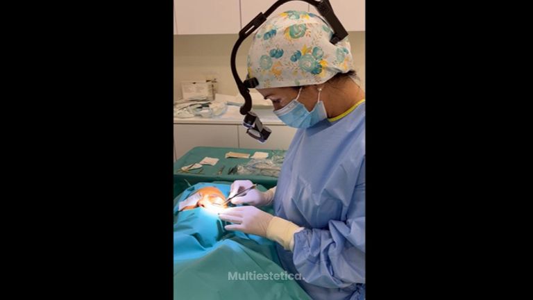 Blefaroplastia interior - Dra. Marta Payá