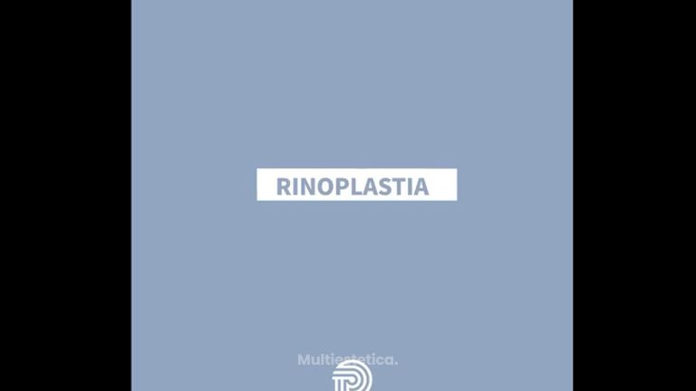 Rinoplastia - Clínica Pérez Espadero