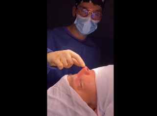 Rinoplastia - Dr. Jorge Noguera