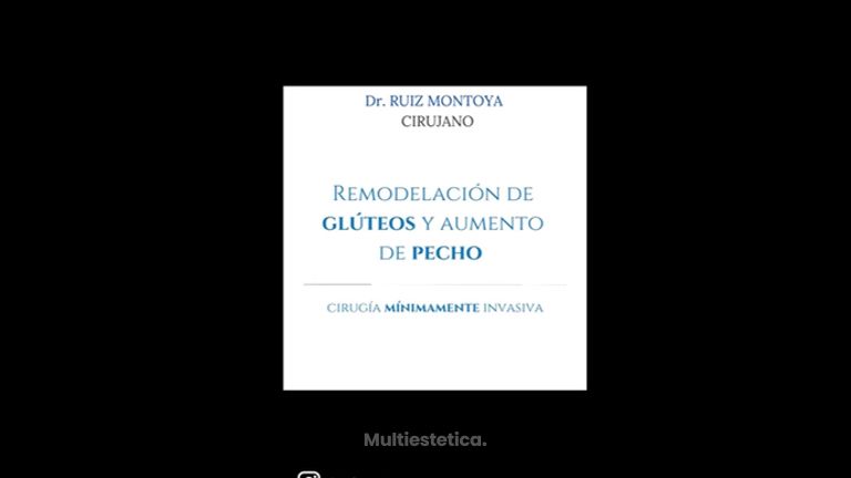 Aumento de pecho y glúteos - Dr. Ruiz Montoya