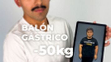 -50 kg en 1 año con Balón Gástrico - Clínica Opción Médica