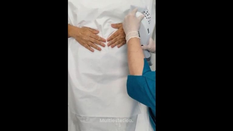 Rejuvenecimiento de manos - Aguilar Rosell. Medicina Estética