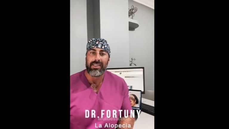 Alopecia - Dr. Josep Antoni Fortuny Cid