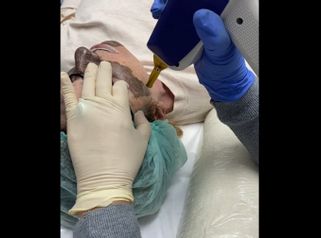 Rejuvenecimiento facial - Balneo Estetic Pasbel