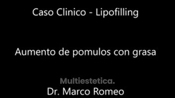 Lipofilling