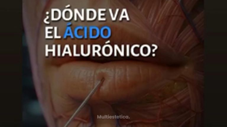 🔝🔝 Medicina Regenerativa. LáserNova Clínica