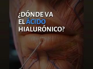 🔝🔝 Medicina Regenerativa. LáserNova Clínica