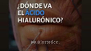 🔝🔝 Medicina Regenerativa. LáserNova Clínica