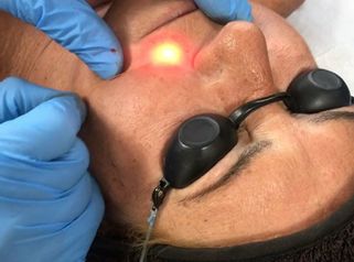 Clínica Dr. Omar López - Láser Endolift
