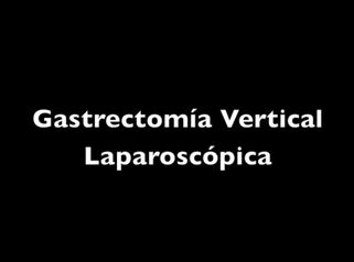 Gastrectomía Vertical Laparoscópica