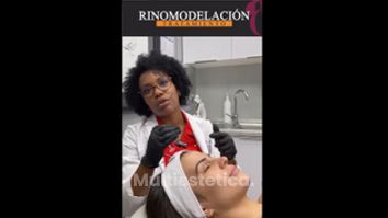 Rinomodelación - Clínica Rigo