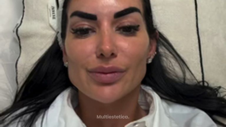 ✨ Mi tratamiento favorito antimanchas- IPL Nordlys by Candela ✨