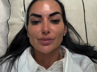 ✨ Mi tratamiento favorito antimanchas- IPL Nordlys by Candela ✨