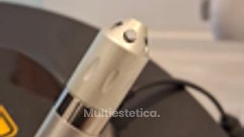 Eliminación de verrugas