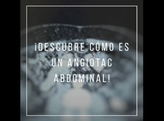 Descubre cómo es un angiotac abdominal - Dr. Pau Bosacoma