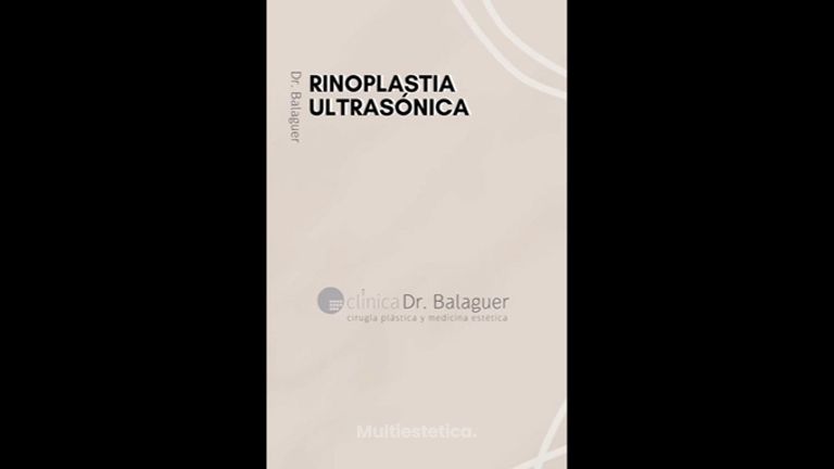 Rinoplastia - Clinica Dr Balaguer