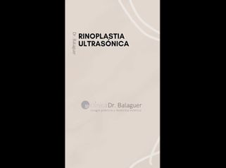 Rinoplastia - Clinica Dr Balaguer