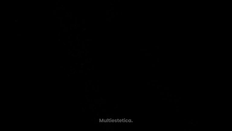 Antes y después Aumento de pecho con prótesis anatómicas 280 cc (resultados a 3 meses)