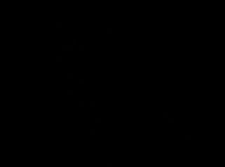 Antes y después Aumento de pecho con prótesis anatómicas 280 cc (resultados a 3 meses)