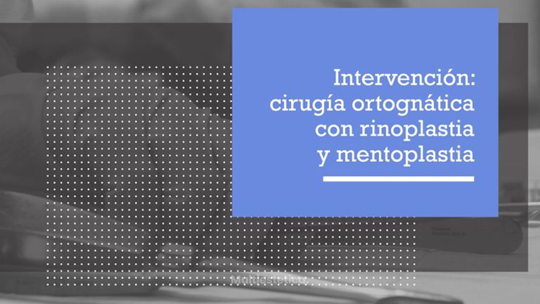 Intervención rinoplastia