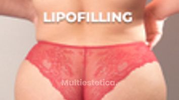 Lipotransferencia - Clínica Opción Médica