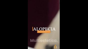 Alopecia - Clínica Rigo